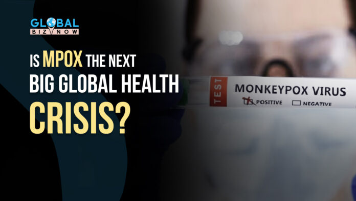 Mpox virus test tube showing positive result, with the text 'Is Mpox the Next Big Global Health Crisis?' alongside the GlobalBizNow logo.